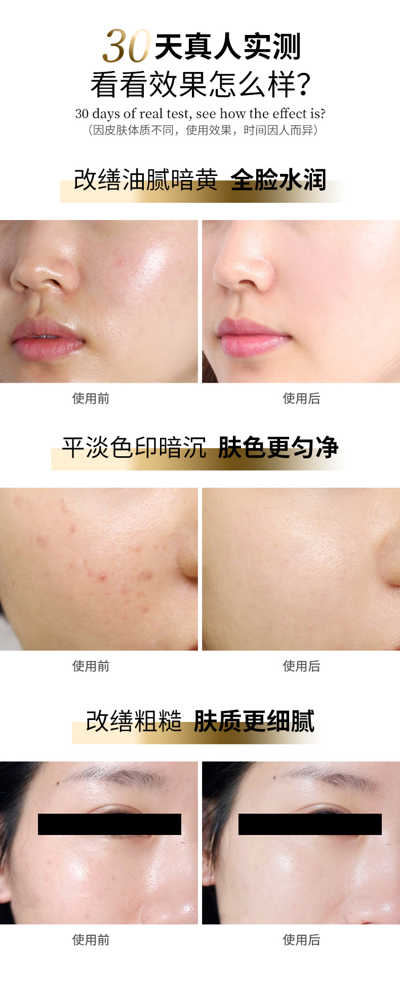 汇赢国际 e932d